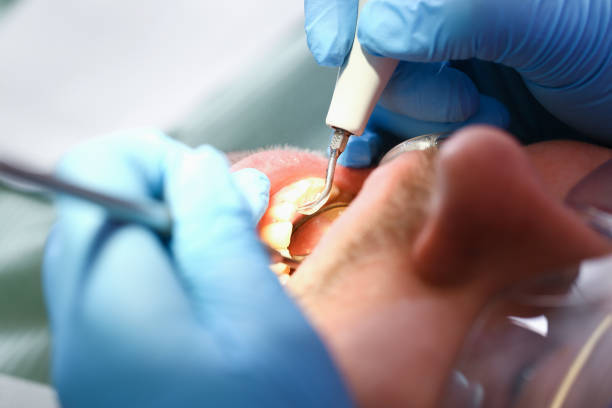 Best Emergency Dentist for Special Needs Patients in Keowee Key, SC