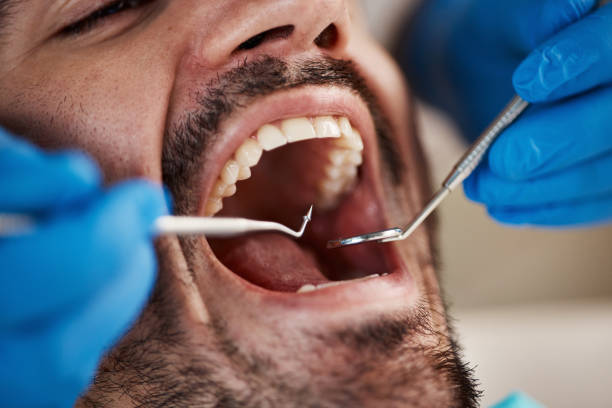 Best Weekend Emergency Dentist in Keowee Key, SC